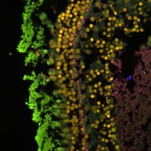 Confocal microscope images of goldfish retina stained to show presence of amyloid precursor protein, associated with Alzheimer's disease.