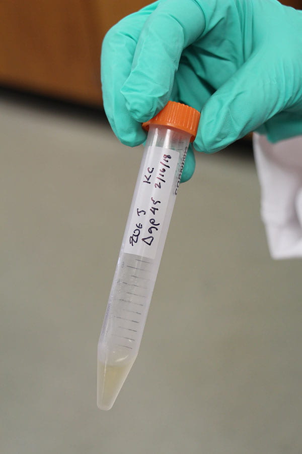 A vial containing ZoeJ, the phage collected at Providence College and successfully used to treat a drug-resistant infection in a young woman in England.
