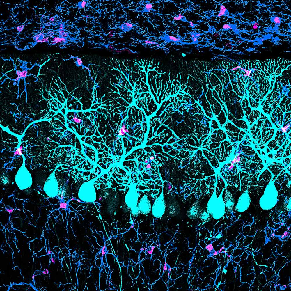 neurons with dendritic trees captured by a fluorescent microscope